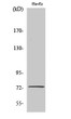 Western blot analysis of various cells using SSH3 Polyclonal Antibody