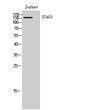Western blot analysis of Jurkat cells using STAG3 polyclonal antibody on cells with nucleus extracted by Minute™ STJ95799