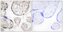 Immunohistochemistry analysis of paraffin-embedded human placenta tissue, using STEAP4 Antibody. The picture on the right is blocked with the synthesized peptide.