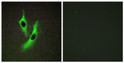 Immunofluorescence analysis of HeLa cells, using STEAP4 Antibody. The picture on the right is blocked with the synthesized peptide.