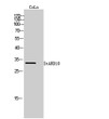 Western Blot analysis of CoLo cells using StARD10 Polyclonal Antibody STJ95802