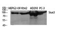Western blot analysis of various cells using Stat3 Polyclonal Antibody diluted at 1：2000
