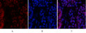 Immunofluorescence analysis of rat-lung tissue. 1, Stat3 Polyclonal Antibody (red) was diluted at 1:200 (4°C, overnight). 2, Cy3 labled Secondary antibody was diluted at 1:300 (room temperature, 50min).3, Picture B: DAPI (blue) 10min. Picture A:Target. Picture B: DAPI. Picture C: merge of A+B