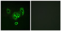 Immunofluorescence analysis of A549 cells using STEA2 Antibody. The picture on the right is blocked with the STJ95823