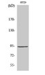 Western blot analysis of various cells using StIp1 polyclonal antibody STJ95824