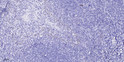 Immunohistochemical analysis of paraffin-embedded human tonsil. 1, Antibody was diluted at 1:200 (4°C overnight). 2, STJ95833