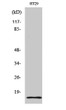 Western blot analysis of various cells using Synuclein-γ polyclonal antibody STJ95864