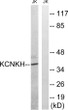 Western blot analysis of lysates from Jurkat cells, using KCNK17 Antibody. The lane on the right was blocked with the STJ95904