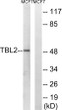 Western blot analysis of lysates from MCF-7 cells, using TBL2 Antibody. The lane on the right was blocked with the STJ95927