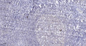 Immunohistochemical analysis of paraffin-embedded human tonsil. 1, Antibody was diluted at 1:200 (4° overnight). 2, STJ95935