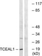 Western blot analysis of lysates from COLO cells, using TCEAL1 Antibody. The lane on the right was blocked with the STJ95938