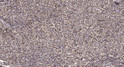 Immunohistochemical analysis of paraffin-embedded human spleen. 1, Tris-EDTA, pH 9.0 was used for antigen retrieval. 2, STJ95938