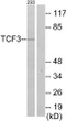 Western blot analysis of lysates from 293 cells, using TCF3 Antibody. The lane on the right is blocked with the synthesized peptide.