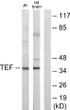 Western blot analysis of lysates from Jurkat and rat brain cells, using TEF Antibody. The lane on the right is blocked STJ95960