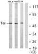 Western blot analysis of lysates from HeLa, HepG2, and Jurkat cells, using ETV6 Antibody. The lane on the right is STJ95964