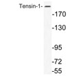 Western blot analysis of lysate from K562 cells, using Tensin-1 antibody.