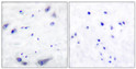 Immunohistochemistry analysis of paraffin-embedded human brain tissue, using Tyrosine Hydroxylase Antibody. The picture on the right is blocked with the synthesized peptide.