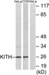 Western blot analysis of lysates from HeLa and COS7 cells, using KITH Antibody. The lane on the right was blocked with STJ96012