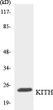 Western blot analysis of the lysates from RAW264.7 cells using KITH antibody. STJ96012