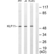 Western blot analysis of lysates from 293, Jurkat, and HUVEC cells, using KLF11 Antibody. The lane on the right was STJ96018