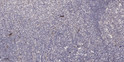 Immunohistochemical analysis of paraffin-embedded human tonsil. 1, Antibody was diluted at 1:200 (4°C overnight). 2, STJ96018