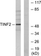 Western blot analysis of lysates from HUVEC cells, using TINF2 Antibody. The lane on the right is blocked with the STJ96027