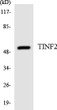 Western blot analysis of the lysates from HeLa cells using TINF2 antibody. STJ96027