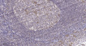 Immunohistochemical analysis of paraffin-embedded human tonsil. 1, Tris-EDTA, pH 9.0 was used for antigen retrieval. 2, STJ96035