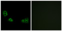 Immunofluorescence analysis of MCF7 cells using TMEM185A Antibody. The picture on the right is blocked with the STJ96045