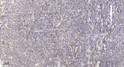 Immunohistochemical analysis of paraffin-embedded human tonsil. 1, Antibody was diluted at 1:200 (4° overnight). 2, STJ96049