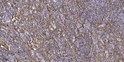 Immunohistochemical analysis of paraffin-embedded human spleen tissue. 1, primary antibody was diluted at 1:200 (4° STJ96063