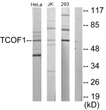 Western blot analysis of lysates from Jurkat, 293, HeLa cells, using TCOF1 Antibody. The lane on the right is blocked with the synthesized peptide.