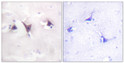 Immunohistochemistry analysis of paraffin-embedded human brain tissue, using Trk B Antibody. The picture on the right is blocked with the synthesized peptide.