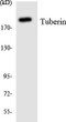 Western blot analysis of the lysates from COLO205 cells using Tuberin antibody.