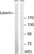 Western blot analysis of lysates from NIH/3T3 cells, using Tuberin Antibody. The lane on the right is blocked with the synthesized peptide.
