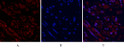 Immunofluorescence analysis of human uterus tissue. 1, Tubulin β Polyclonal Antibody (red) was diluted at 1:200 (4°C, STJ96145