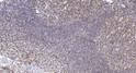 Immunohistochemical analysis of paraffin-embedded human tonsil. 1, Antibody was diluted at 1:200 (4° overnight). 2, STJ96166
