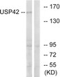 Western blot analysis of lysates from HT-29 cells, using USP42 Antibody. The lane on the right is blocked with the synthesized peptide.