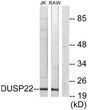 Western blot analysis of lysates from RAW264.7 and Jurkat cells, using DUSP22 Antibody. The lane on the right was STJ96242