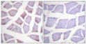 Immunohistochemistry analysis of paraffin-embedded human skeletal muscle tissue, using XIAP Antibody. The picture on the right is blocked with the synthesized peptide.