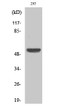 Western blot analysis of 293 cells using XIAP Polyclonal Antibody diluted at 1：1000. Secondary antibody was diluted at 1:20000