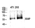 Western blot analysis of various cells using XIAP Polyclonal Antibody diluted at 1：1000. Secondary antibody was diluted at 1:20000