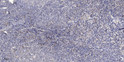 Immunohistochemical analysis of paraffin-embedded human tonsil. 1, Antibody was diluted at 1:200 (4° overnight). 2, STJ96281