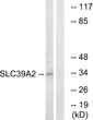 Western blot analysis of lysates from Jurkat cells, using SLC39A2 Antibody. The lane on the right is blocked with the synthesized peptide.