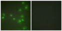 Immunofluorescence analysis of HUVEC cells, using ZNF265 Antibody. The picture on the right is blocked with the synthesized peptide.