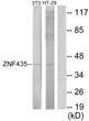 Western blot analysis of lysates from NIH/3T3 and HT-29 cells, using ZNF435 Antibody. The lane on the right is blocked with the synthesized peptide.