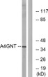 Western blot analysis of lysates from K562 cells, using A4GNT Antibody. The lane on the right was blocked with the STJ96365