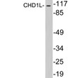Western blot analysis of lysates from HepG2 cells, using CHD1L antibody.