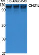 Western blot analysis of extracts from NIH-3T3, Jurkat, A549 cells, using CHD1L Polyclonal Antibody.. Secondary antibody was diluted at 1:20000 cells nucleus extracted by Minute TM Cytoplasmic and Nuclear Fractionation kit (SC-003, Inventbiotech, MN, USA).