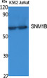 Western Blot analysis of extracts from K562 and Jurkat cells, using SNM1B Polyclonal Antibody. Secondary antibody STJ96429